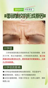 眼睑皱纹注射治疗指南