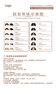 男女脱发等级示意图
