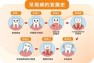 牙齿龋病发展史图示