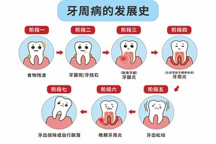 牙周病发展史图示