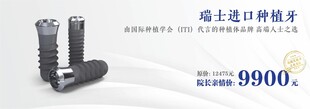 种植牙banner