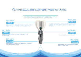 种植牙优势科普图解