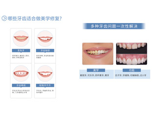 牙齿美学修复科普