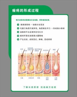 痤疮的形成过程