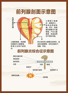  前列腺炎解刨图
